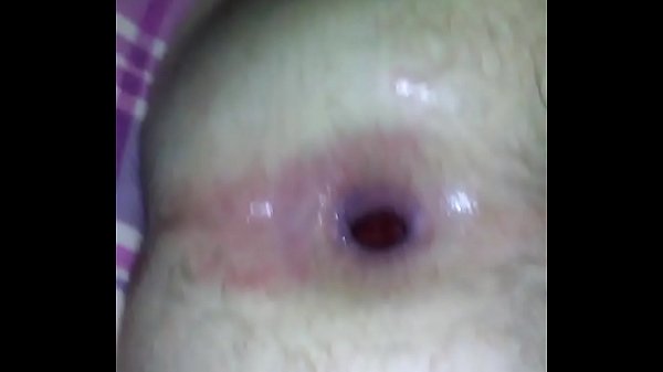 Drug Infusion! (Part 2)